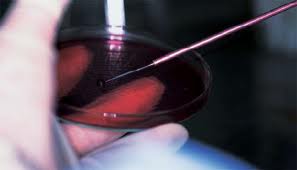 WHO:血液测试检测结核会产生错误的结果