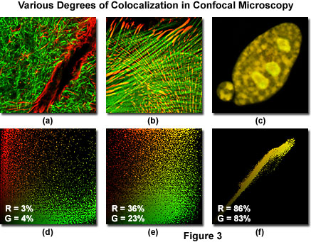 奥林巴斯显微镜荧光共聚焦显微镜中的共定位