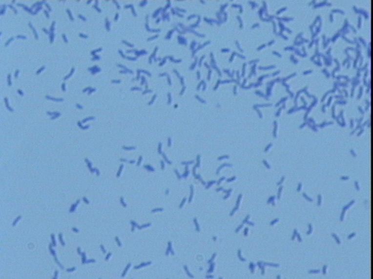 极小单胞菌是什么？