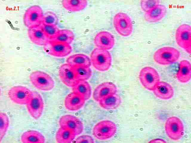 血球细胞