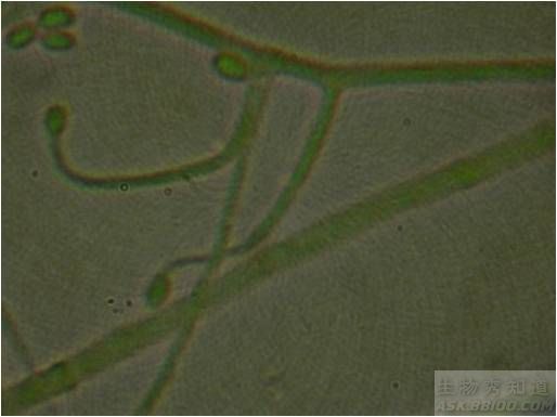 真菌菌丝进行观察1