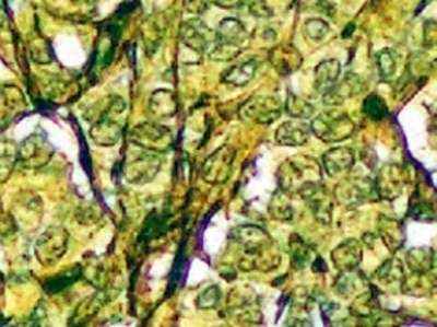 显微镜载玻片可以通过揭示细胞的颜色来改善癌症诊断