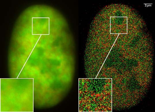 超分辨率显微镜：共定位显微镜 (2CLM) 与 GFP 和 RFP 融合蛋白