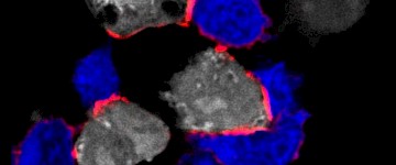最新研究发现镁对免疫系统在对抗癌症至关重要