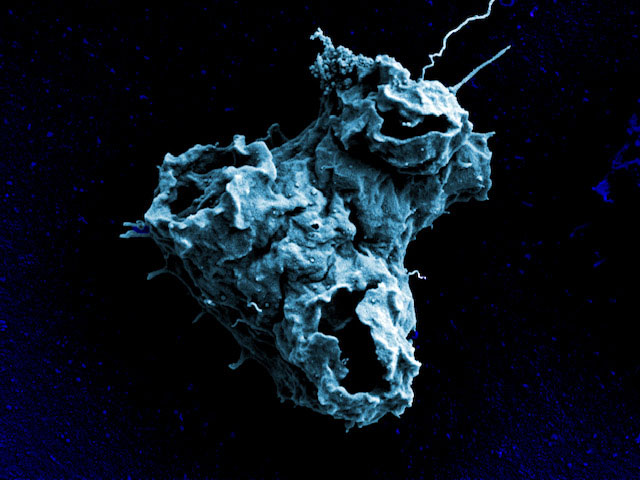 Naegleria gruberi 变形虫细胞表面