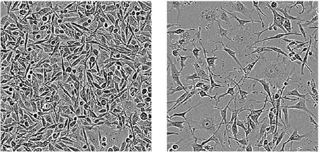 三阴性乳腺癌细胞 RNA 结合蛋白